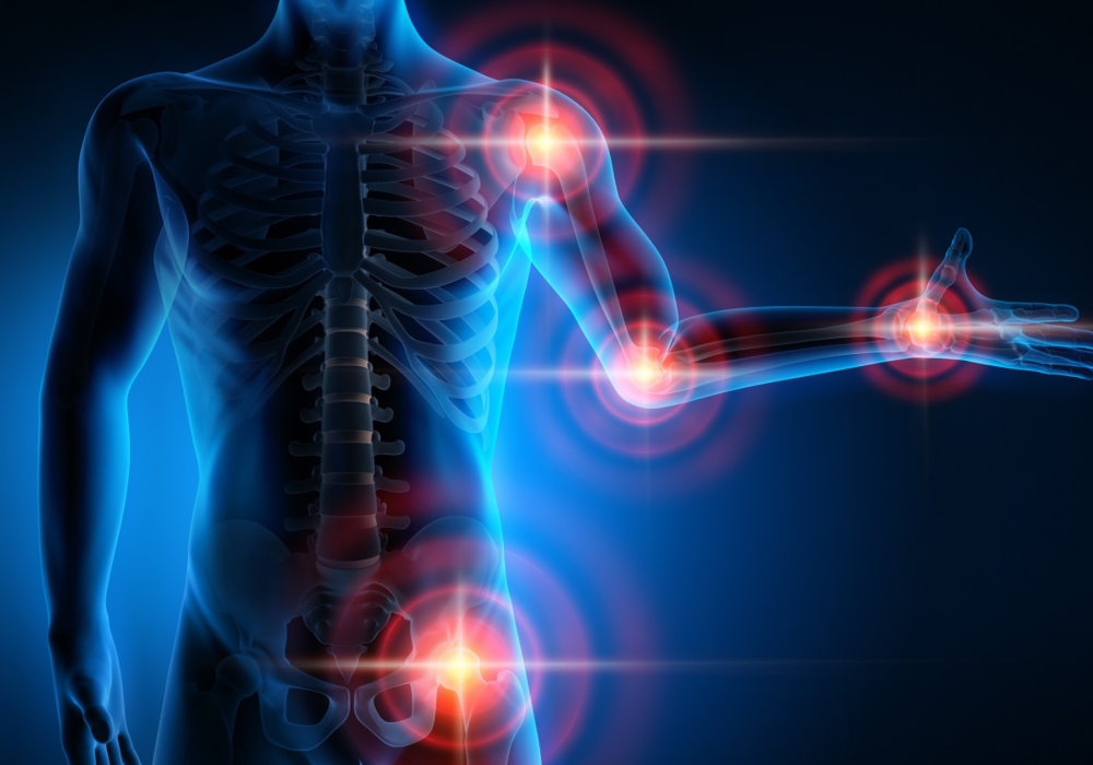 Troubles ostéo-musculo-articulaires